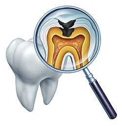 The image shows a magnified view of a tooth with an X-ray film inserted into a dental mirror, allowing for examination of its internal structure which includes the pulp chamber, root canals, and surrounding tissues.