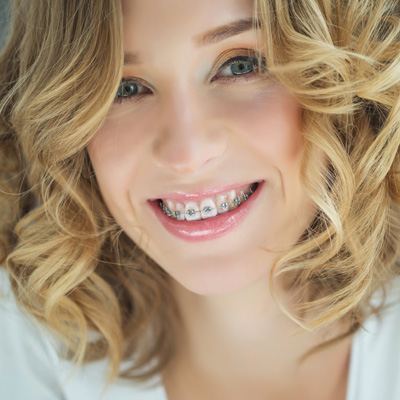 The image shows a woman smiling at the camera with braces, wearing a white top and her hair styled in loose waves.