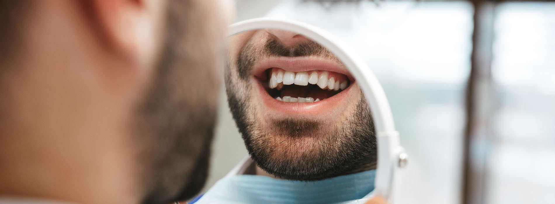 A man with a beard sitting in a dental chair, smiling broadly while looking up at the camera, with a dentist s mirror in front of him.