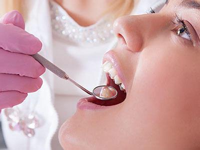 A woman receiving dental treatment, with a dentist using a drill on her teeth while she wears gloves and a face mask.